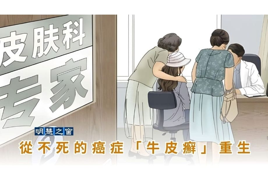 從不死的癌症「牛皮癬」重生